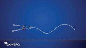 视频导管 国产,创新驱动下的医疗技术突破